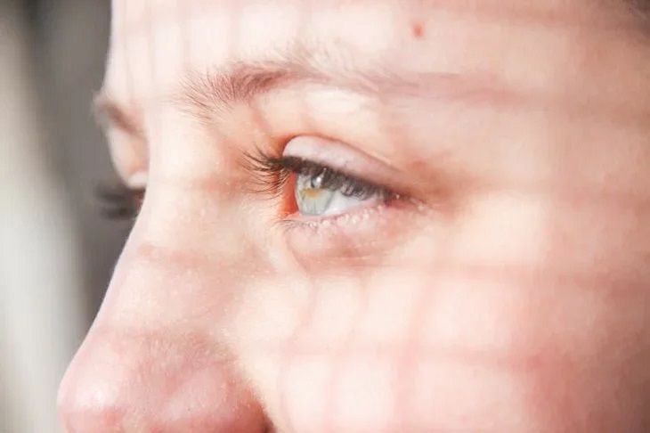 Эксперты назвали способы определить нехватку витамина В12 по глазам
