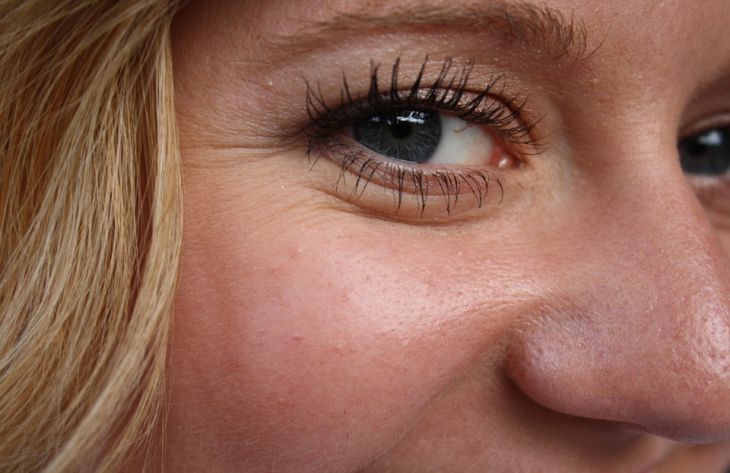 Косметологи рассказали о причинах возникновения морщин вокруг глаз