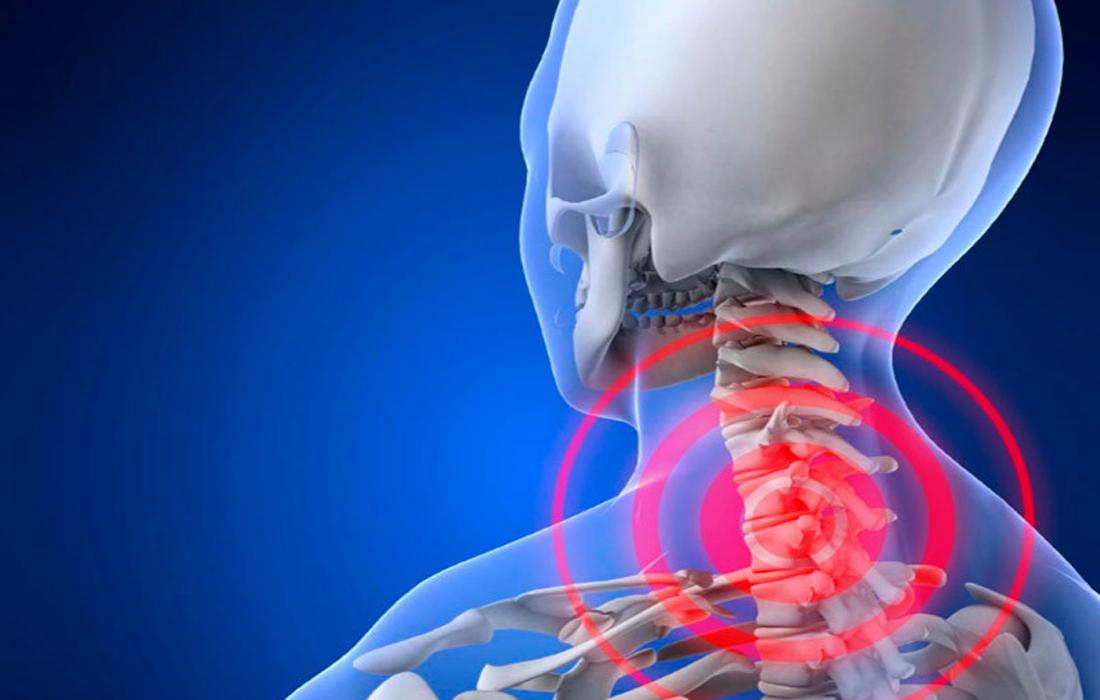 8 потрясающих упражнений от шейного остеохондроза