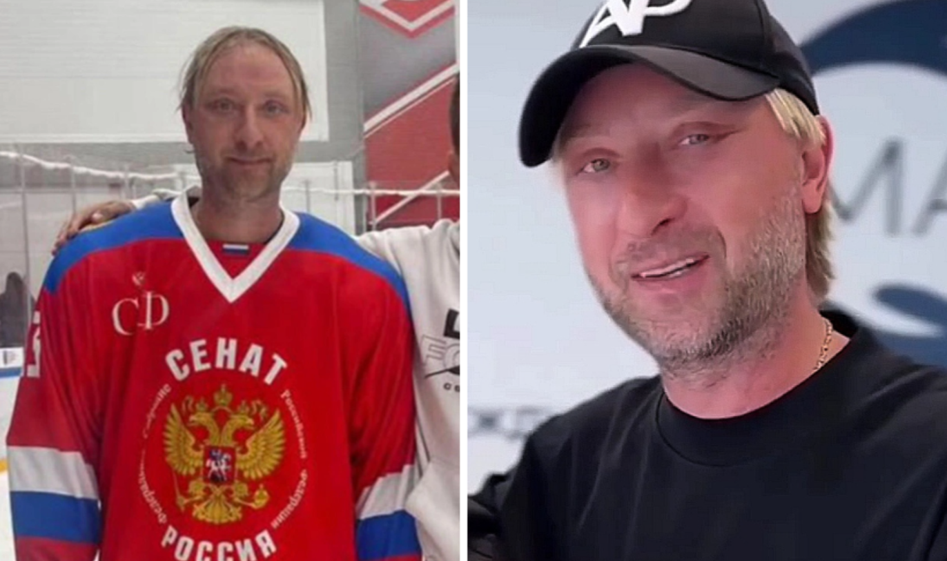 Евгений Плющенко решился на пластическую операцию