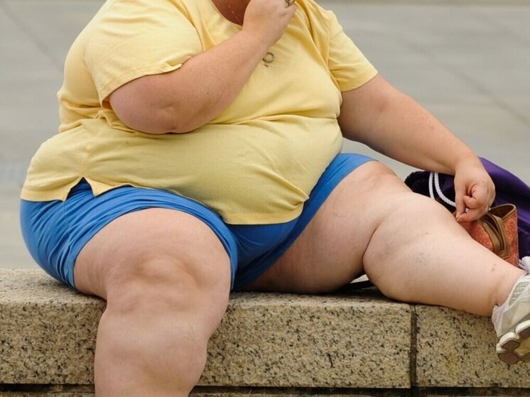 В Карелии фиксируется все больше и больше людей с ожирением