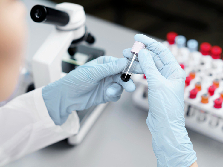 В России разработан экспресс-тест для диагностики сальмонеллеза