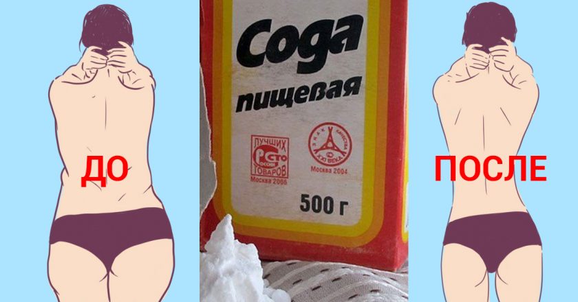 Как с помощью соды избавиться от жировых отложений за 48 часов… Действенный метод!