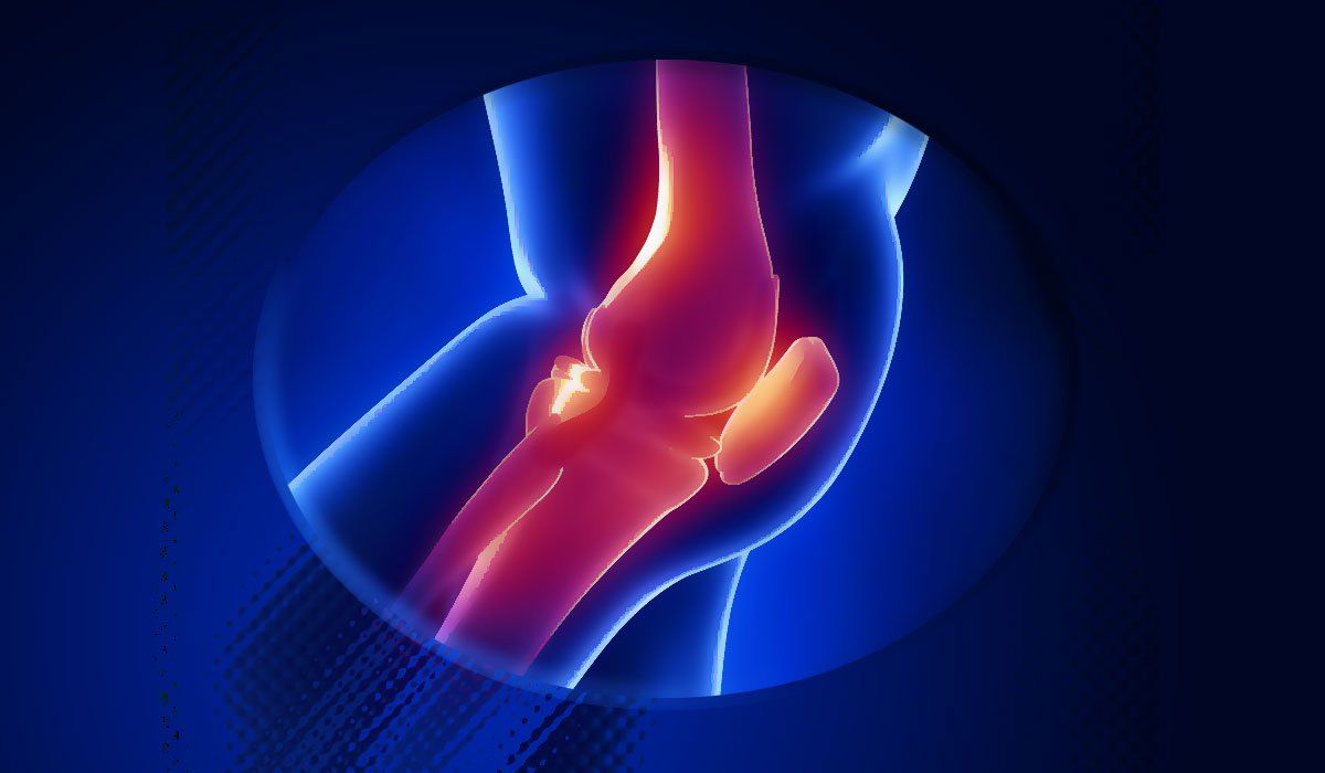 Моя любимая растирка от болей в мышцах и суставах