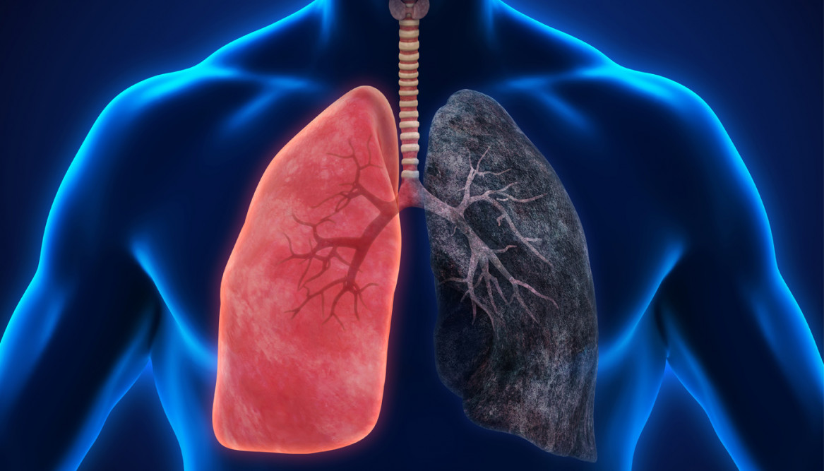 Проверяем в домашних условиях, нет ли проблем с легкими