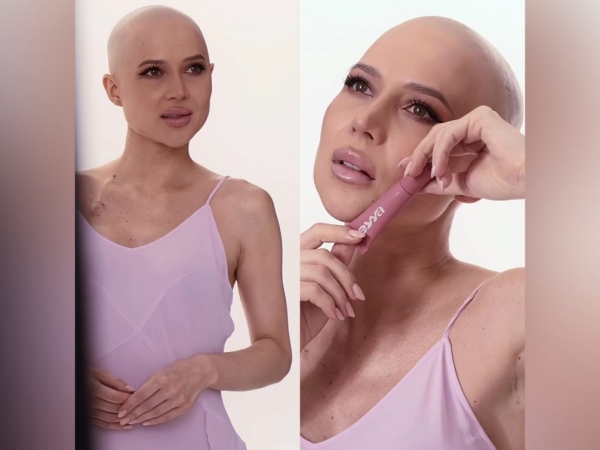 Больная раком Лерчек запустила новый бренд: фотосессия без волос и косметика в честь городов России&nbsp;